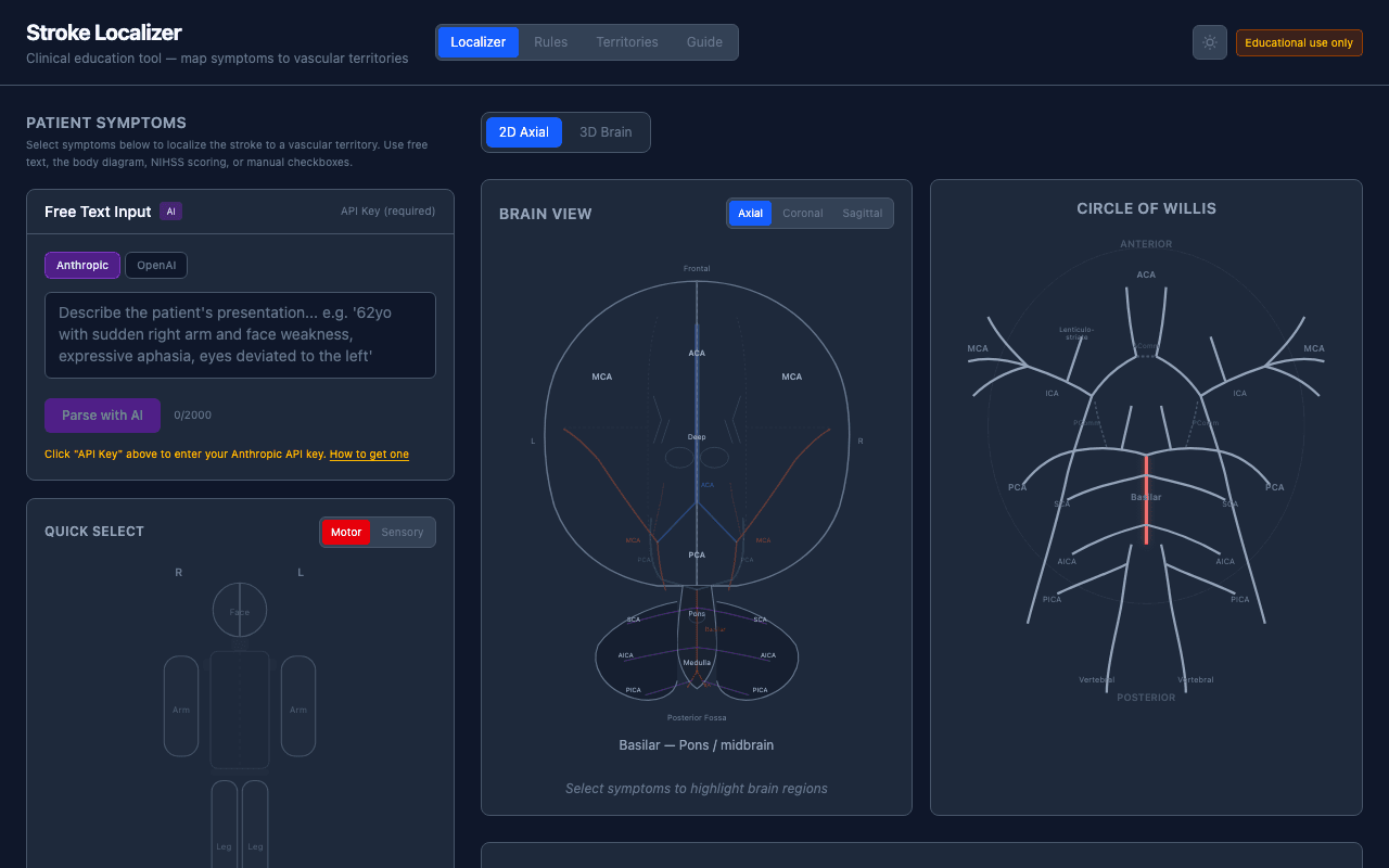 Stroke Localizer screenshot